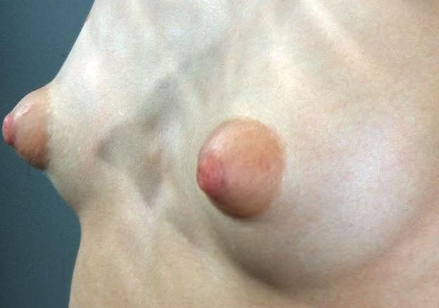 Pointy Nipples